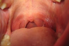 IMG_3881-01