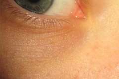 IMG_4962-01